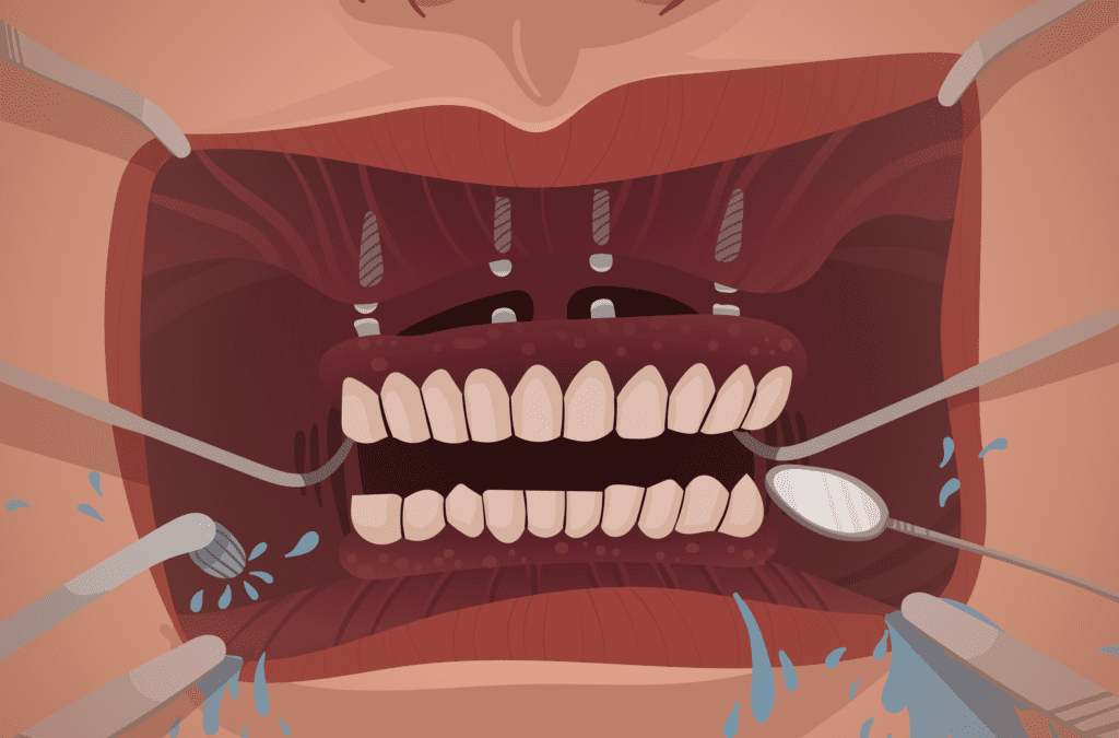 What Is a Full Mouth Reconstruction?