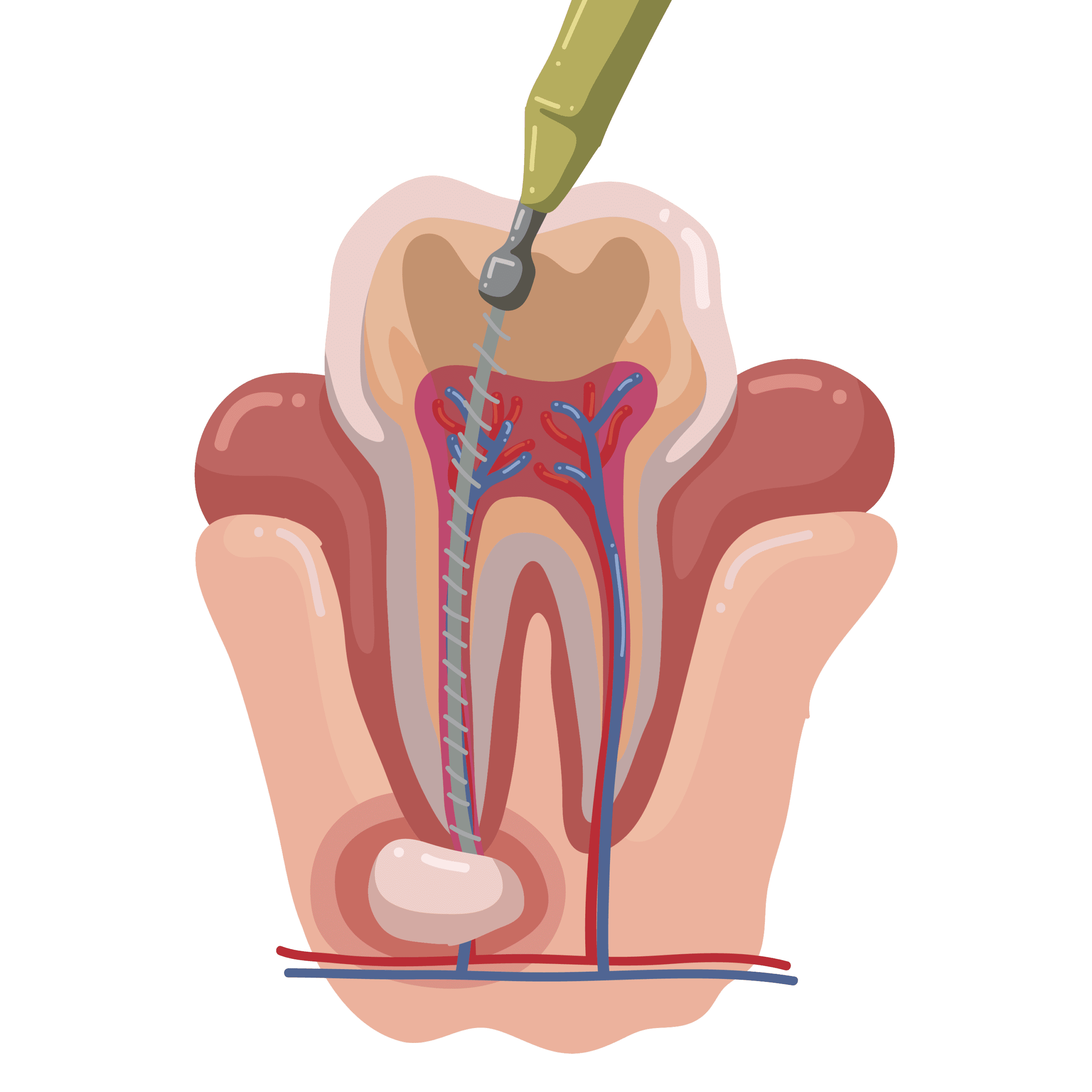 when-do-i-need-a-root-canal-about-our-houston-root-canal-treatment