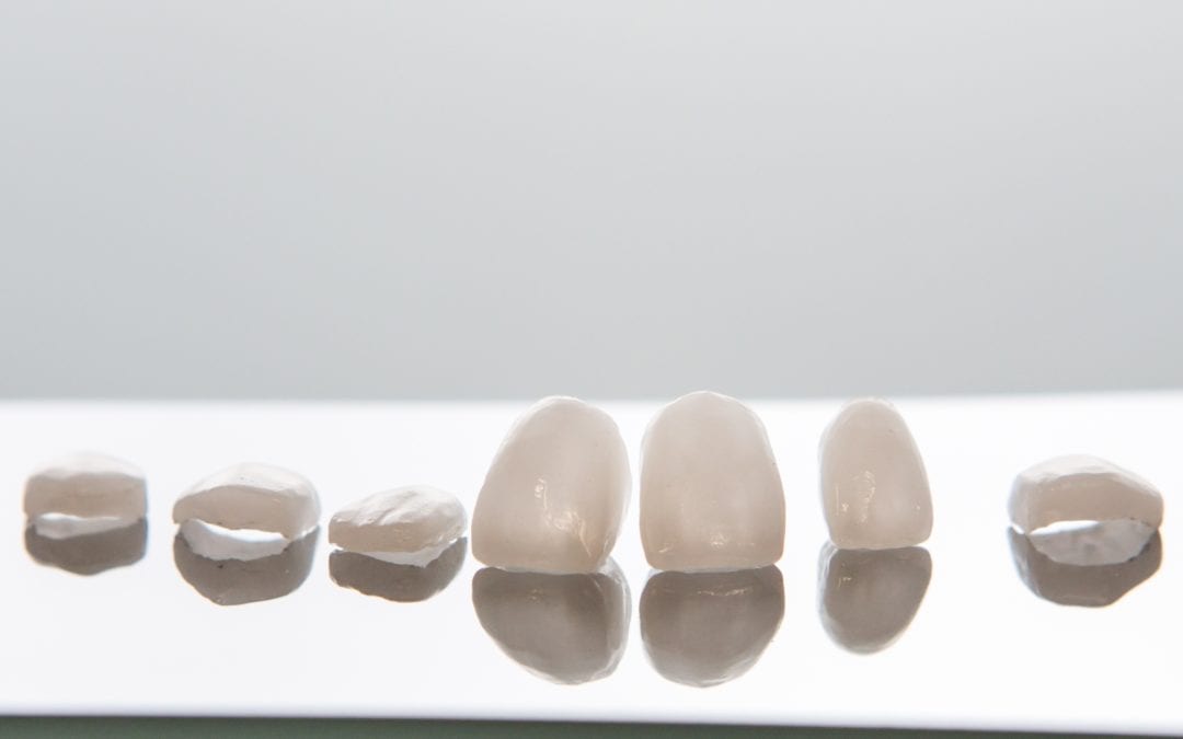 How Porcelain Veneers Can Transform a Smile